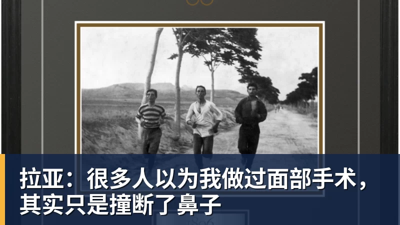 拉亚:很多人以为我做过面部手术,其实只是撞断了鼻子